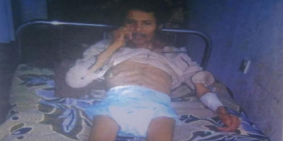 دعوة لاهل الخير.. توفير كرسي كهربائي لشاب جنوبي معاق ليتمكن من الحركة 