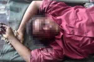 إنفجار لغم حوثي يمزق شابًا في حيس