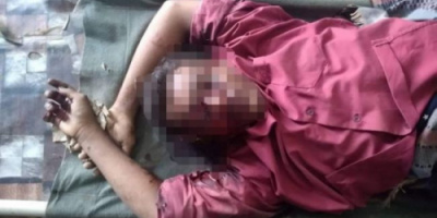 إنفجار لغم حوثي يمزق شابًا في حيس