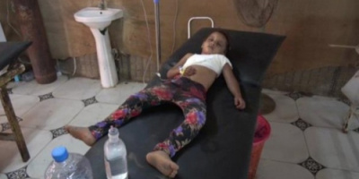 إصابة طفلة بشظايا قذيفة هاون جراء قصف مليشيات الحوثي على الدريهمي