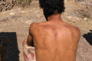 مسلحو الحوثي يعتدون بالضرب المبرح على مواطن بمنطقة مراوسة التابعة لمديرية ماوية