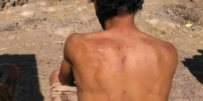 مسلحو الحوثي يعتدون بالضرب المبرح على مواطن بمنطقة مراوسة التابعة لمديرية ماوية