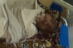 مصرع وإصابة 3 أشخاص بحادث مروع في لحج