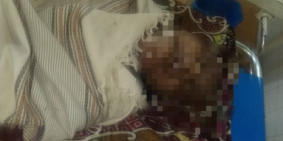 مصرع وإصابة 3 أشخاص بحادث مروع في لحج