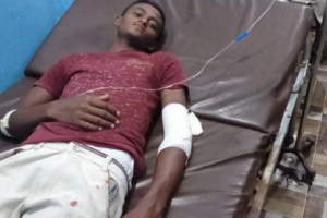 إصابة مواطن بقناصة مليشيات الحوثي في حيس
