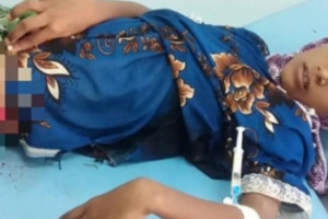 إصابة طفلة بنيران قناصة مليشيات الحوثي في الجبلية بالحديدة 