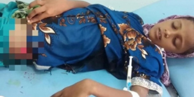 إصابة طفلة بنيران قناصة مليشيات الحوثي في الجبلية بالحديدة 