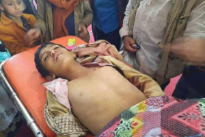 مقتل طفل برصاص قناصة المليشيات الحوثية بمريس شمال الضالع