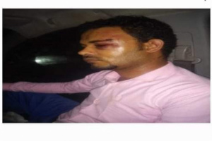 طبيب بردفان يروي تفاصيل الاعتداء الذي تعرض له من قبل مسلحين
