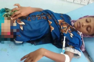  مصدر طبي يكشف عن مقتل (22) مدنيًا بنيران مليشيات الحوثي الإرهابية بالحديدة