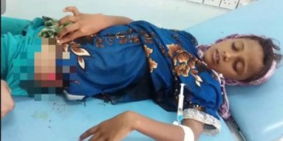  مصدر طبي يكشف عن مقتل (22) مدنيًا بنيران مليشيات الحوثي الإرهابية بالحديدة