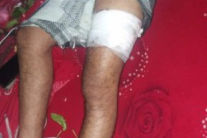 عصابة حوثية تعتدي على 3 مواطنين بالخناجر بإب