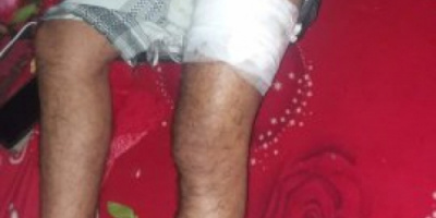 عصابة حوثية تعتدي على 3 مواطنين بالخناجر بإب