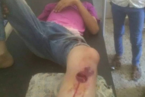 إصابة أربعة مدنيين ببقايا مقذوفات متفجرة في حادثين منفصلين شمال وشمال غرب الضالع