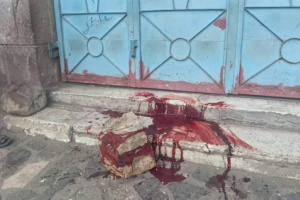 قتلى وجرحى مدنيون في قصف حوثي على وسط مدينة تعز 