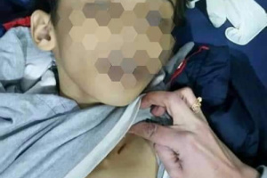 عذبت إبن زوجها ذو ال8 سنوات حتى الموت 