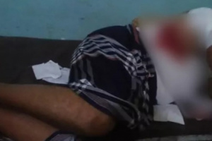 إصابة مواطن برصاص قناصة مليشيات الحوثي في مدينة حيس