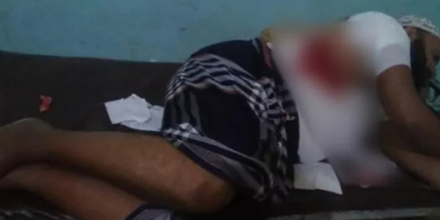 إصابة مواطن برصاص قناصة مليشيات الحوثي في مدينة حيس