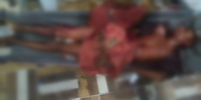 استشهاد مواطنان وإصابة آخر في قصف حوثي على قرى حيس بالحديدة