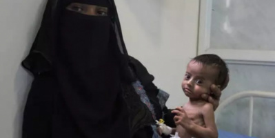 نصف سكان اليمن مهددون بالموت جوعاً