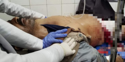 أحد ضحايا الحوثي الجديدة..تعرف عليها