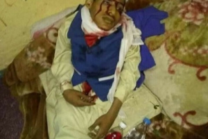 تفاصيل جديدة في جريمة هزت مدينة إب  