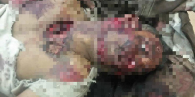 مصرع شخصان بسبب حادث مروري بتبن لحج