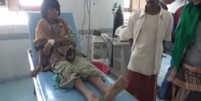 جرح مسنة برصاص مليشيا الحوثي في مديرية حيس 