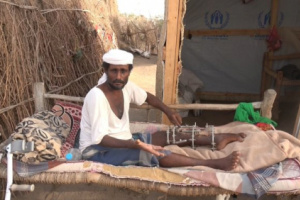 حصلية رصاصة حوثية.. أب معاق وأسرة نازحة مكونة من 8 أفراد