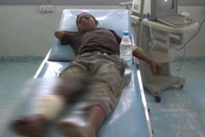 إصابة طفل برصاص مليشيات الحوثي في منطقة الدنين شمال غرب حيس