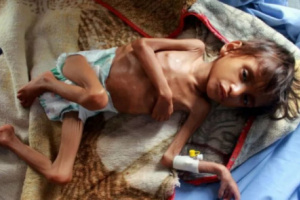 الجرائم الحوثية.. كيف تفاقم أعباء الجوع والفقر؟