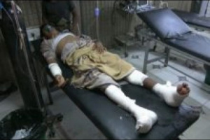 استشهاد مدني وإصابة 5 آخرين في هجوم للحوثيين بطائرة مسيرة بالدريهمي الحديدة