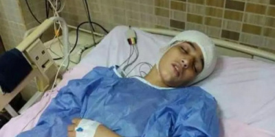  غرس مفتاح في رأس زميله.. إيداع نجم ذا فويس كيدز أسبوعا بإحدي دور الرعاية 