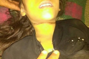 تفاصيل جديدة لحادثة طفلة خنقها ثعبان في تعز 