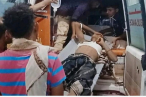 إصابة مدنيين اثنين برصاص قناص حوثي في حيس