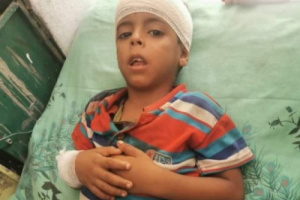 إصابة طفل جراء قصف مليشيا الحوثي على قرى ثره