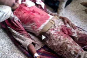 مودية..حصيلة أولية ..قتيلين و25 جريح في انفجار معسكر اللواء خامس مشاه التابع للشرعية
