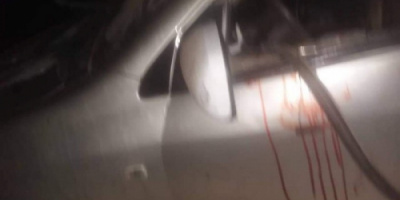 انفجار قنبلة داخل سيارة بنقيل سمارة في إب