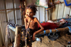 البنك الدولي: 70 بالمئة من سكان اليمن يواجهون خطر المجاعة