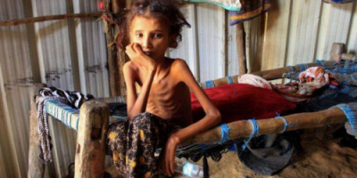 البنك الدولي: 70 بالمئة من سكان اليمن يواجهون خطر المجاعة