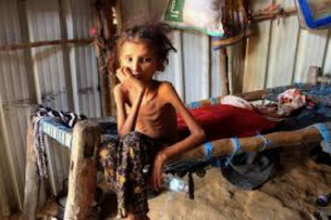 اليونسيف تكشف عن وفاة طفل كل عشر دقائق في اليمن