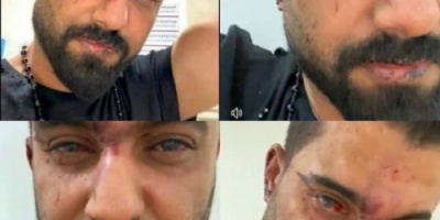 الفنان العدني عدنان الخضر يتعرض لاعتداء دموي من قبل الأمن التركي