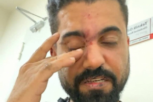 منصور صالح يدين جريمة الاعتداء الآثم التي تعرض لها الممثل الجنوبي عدنان الخضر على ايدي الأمن التركي