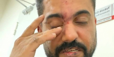 منصور صالح يدين جريمة الاعتداء الآثم التي تعرض لها الممثل الجنوبي عدنان الخضر على ايدي الأمن التركي