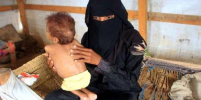 الغارديان : 5 ملايين على شفا المجاعة و 16 مليون آخرين يسيرون بنفس الاتجاه