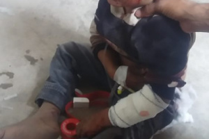 مقذوف من مخلفات مليشيا الحوثي يصيب طفل بجروح متفرقة في كرش 