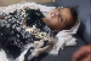 لحج.. وفاة طفلة تبلغ من العمر أربع سنوات بسبب أرجوحة حبلية بردفان ..