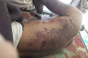 شهيد وجريحان في تفجيرين استهدفا القوات الجنوبية بمودية 