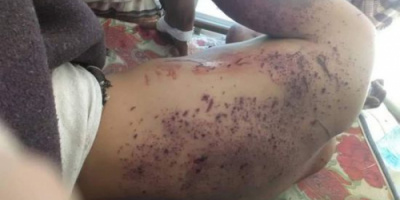 شهيد وجريحان في تفجيرين استهدفا القوات الجنوبية بمودية 