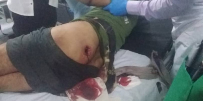 إصابة البطل حسين إثر اشتباكات مع مليشيات الحوثي في جبهة حجر بالضالع